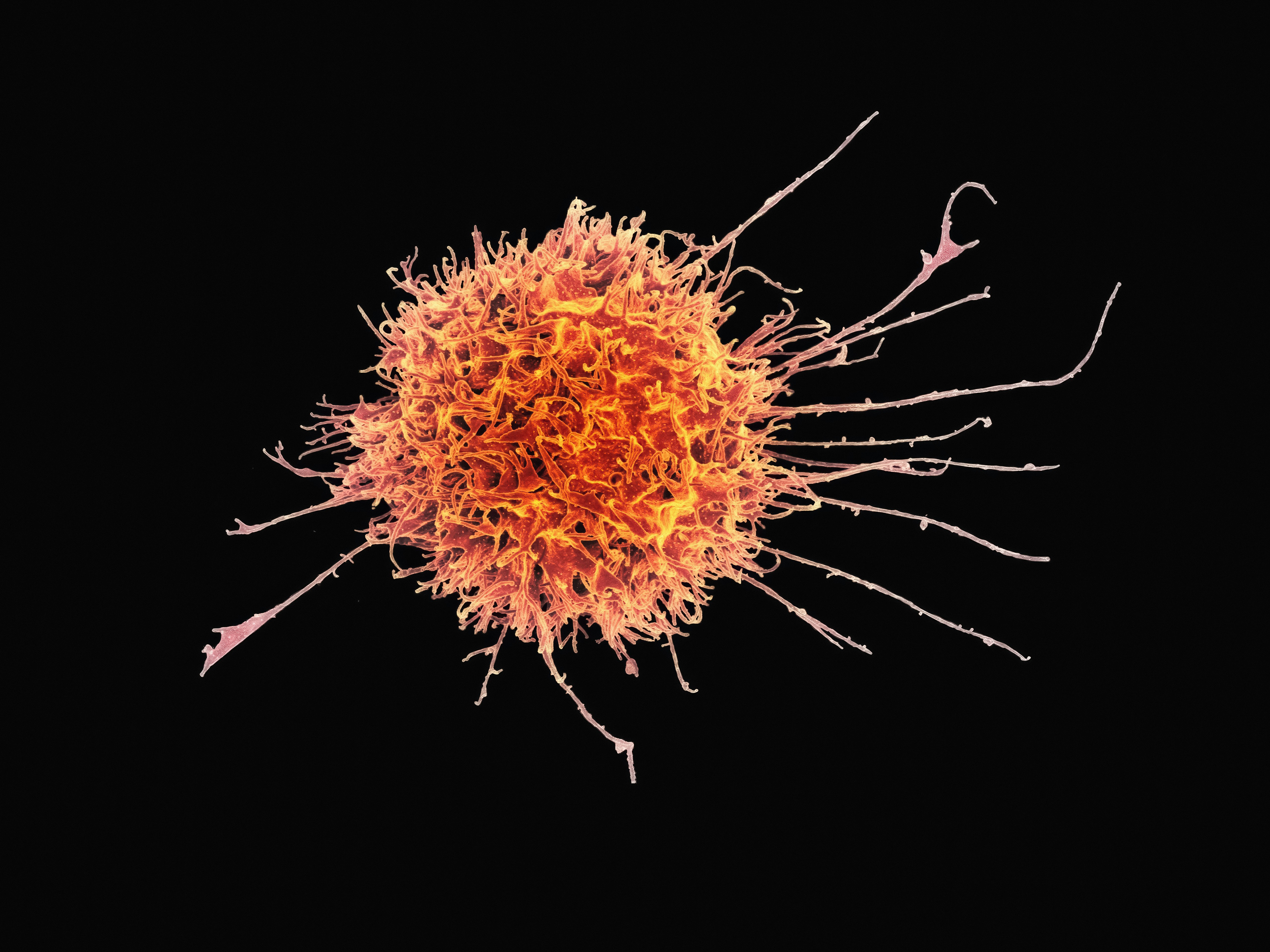 Scanning electron microscope image of a Natural Killer cell, pseudo-colored, showing characteristic surface projections